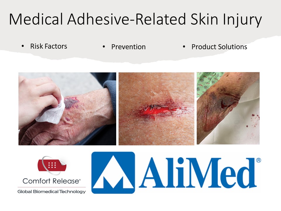 Medical AdhesiveRelated Skin Injury Awareness